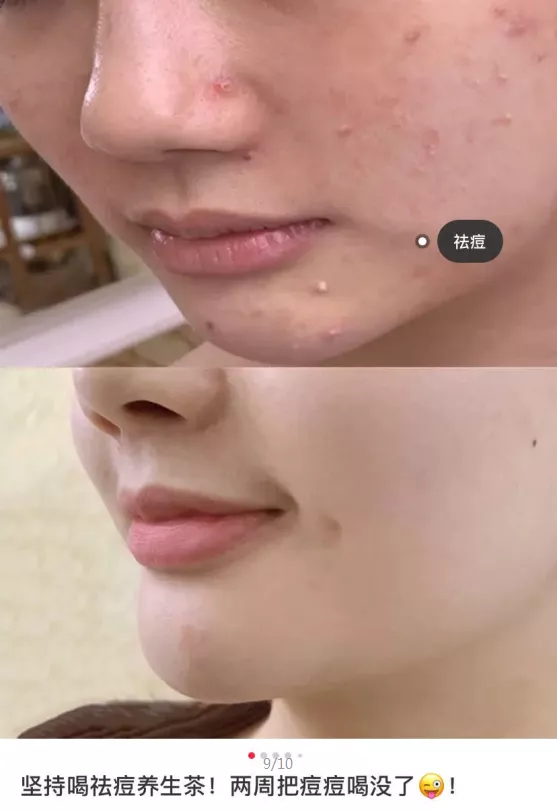 曾红极一时的玫瑰花茶,究竟有没有美白的功效《养生谣言》