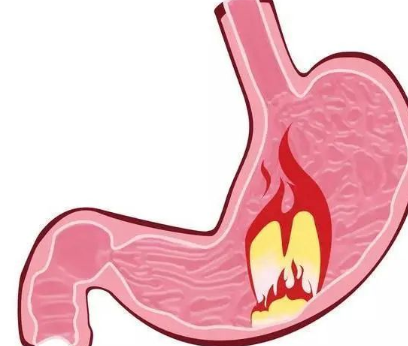消化科主任:身体出现2种情况,怕是胃病“恶化”,别忽视