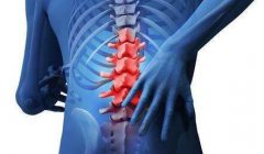 腰椎间盘突出 腰痛 会出现6种情况