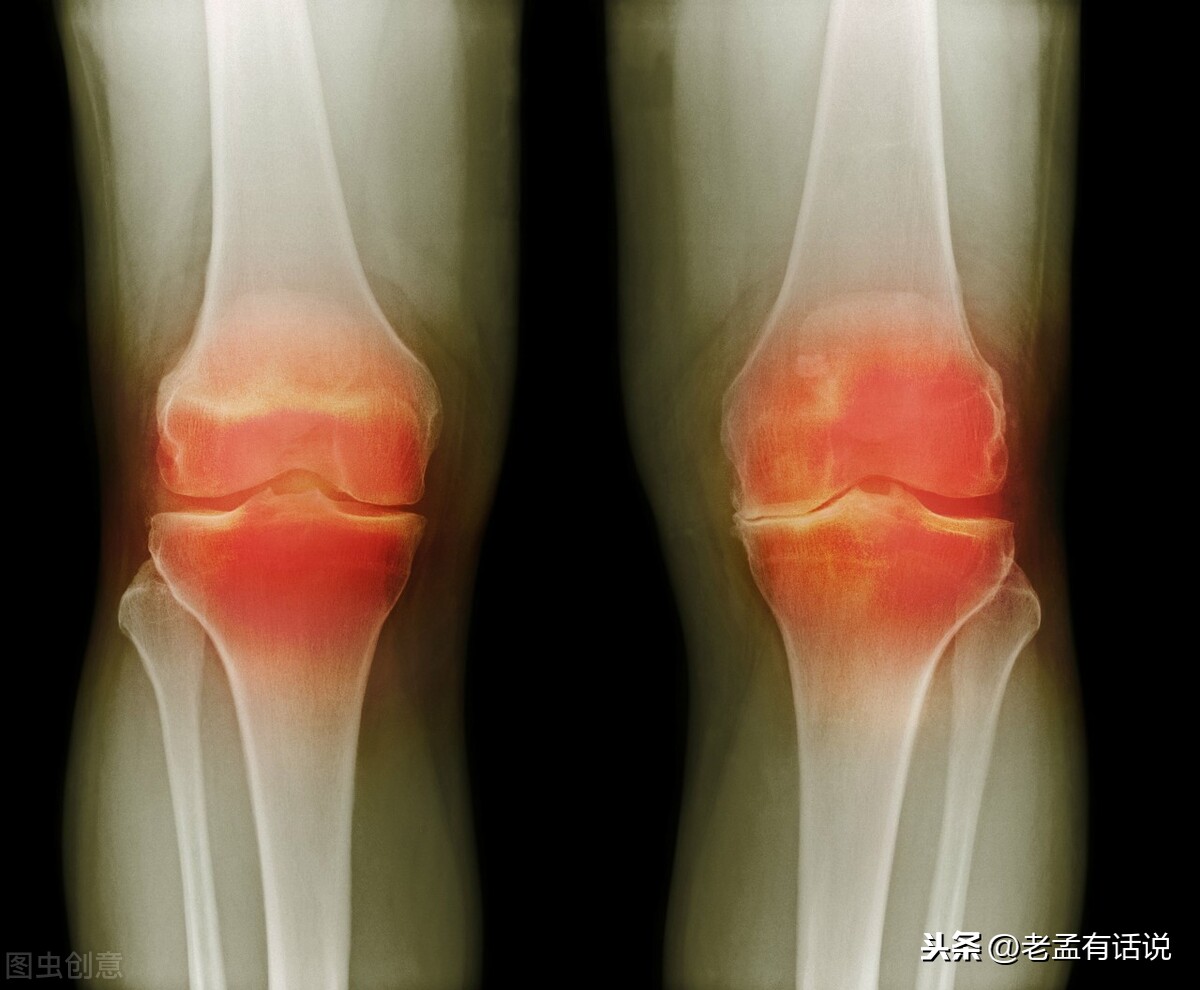 为什么冬季膝关节炎疼痛会加重？如何防治比较有效？