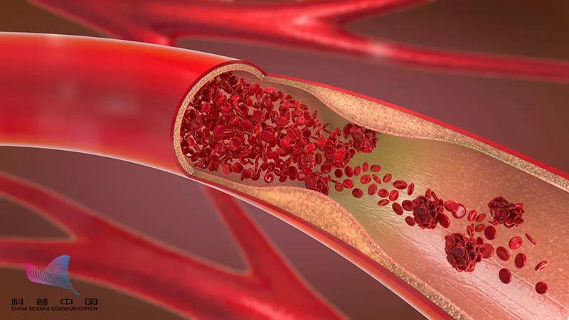 血管里有垃圾，定期输液通血管？医生：这些做法坑你没商量…