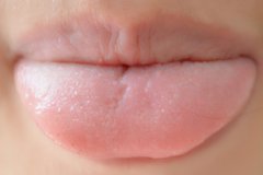 当舌头出现什么异常时，可能暗示体内
