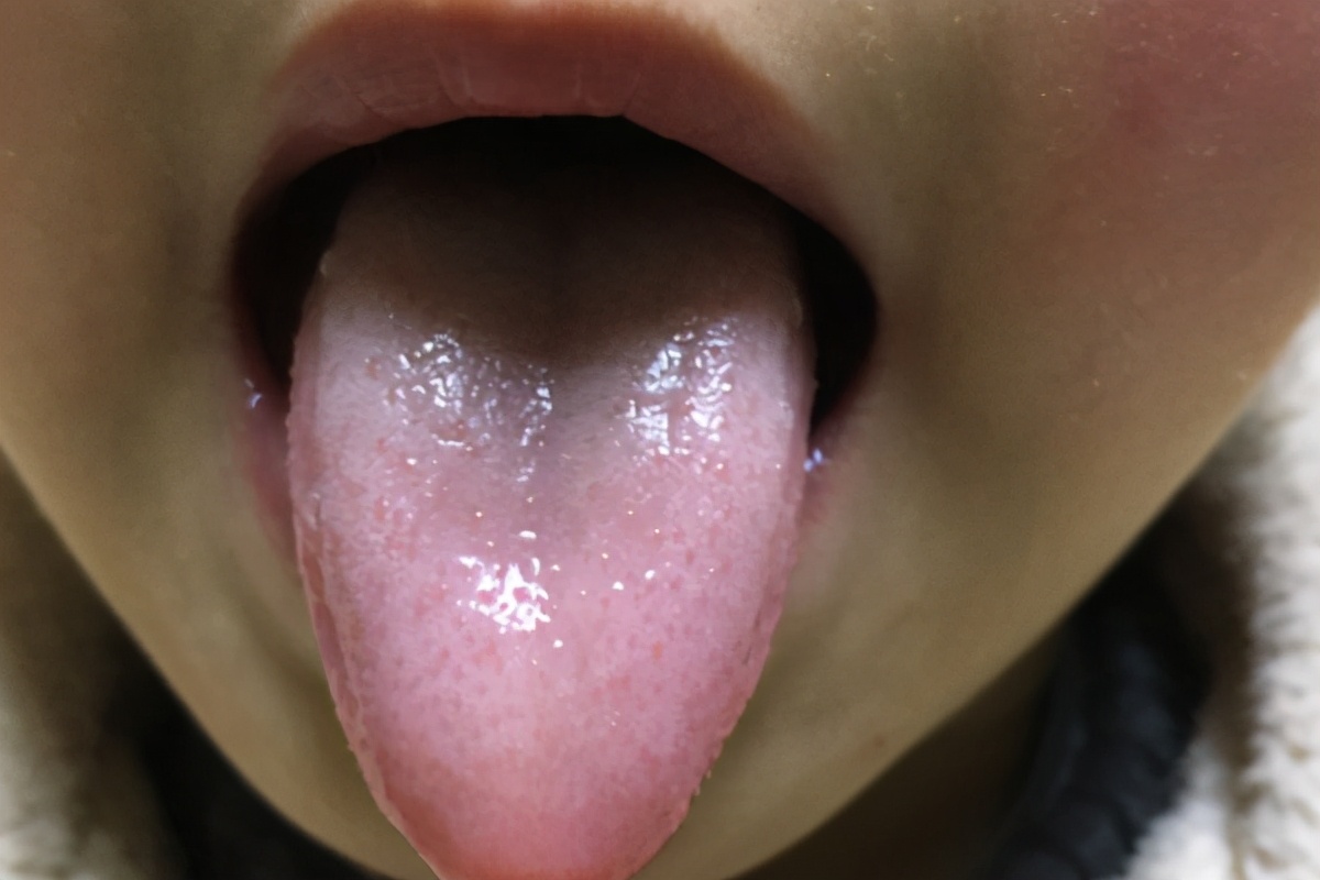 从舌头看健康：舌头出现什么样的异常，暗示体内有疾？