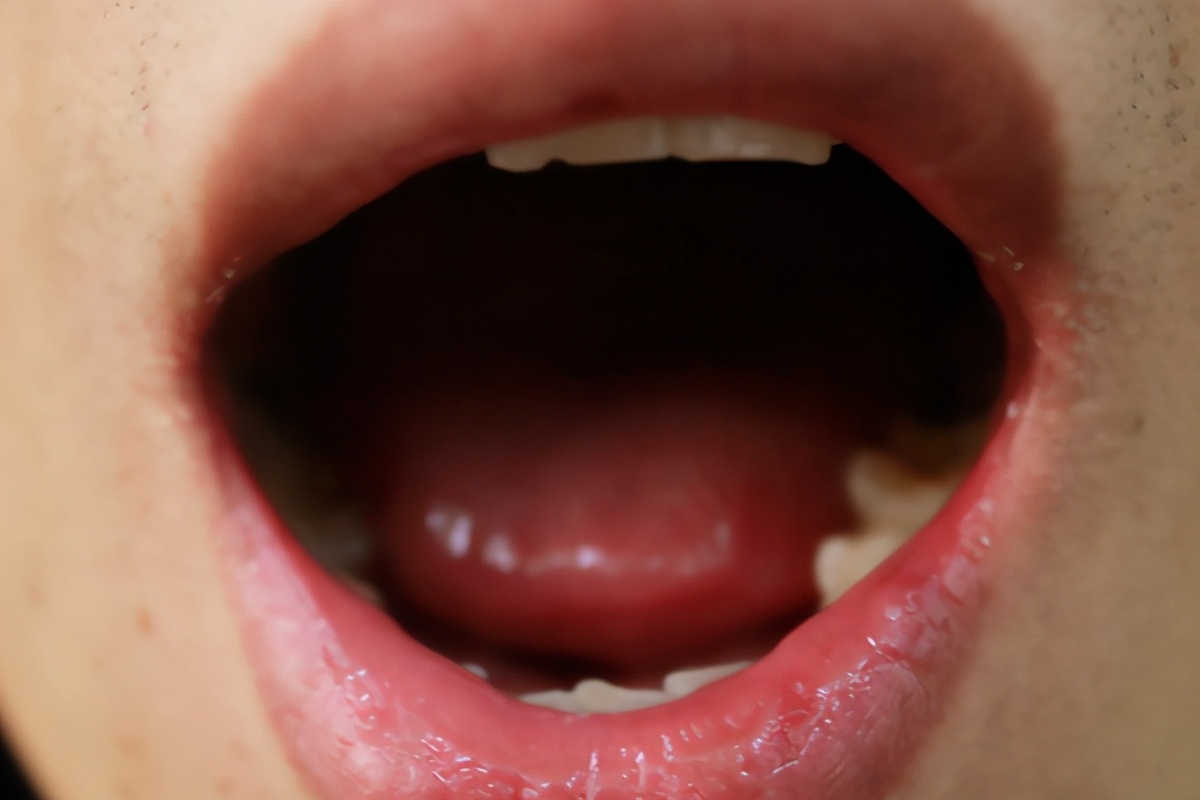 从舌头看健康：舌头出现什么样的异常，暗示体内有疾？