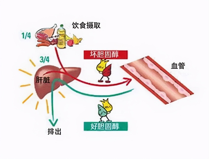 身体不胖，饮食也很注意，胆固醇就不会升高了吗？医生为您讲清楚