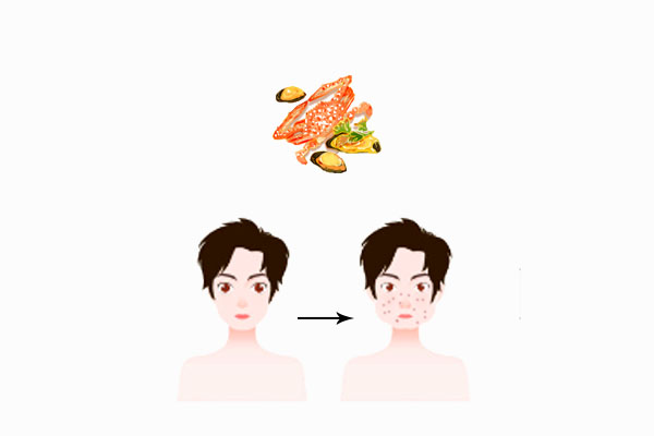为何得了皮肤病不能吃海鲜?