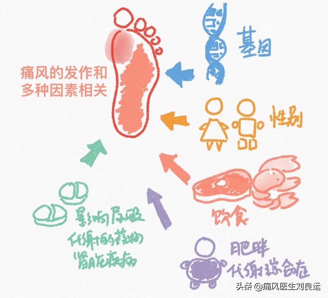 痛风是吃出来的病?尿酸高还是喝出来、累出来、懒出来和胖出来的