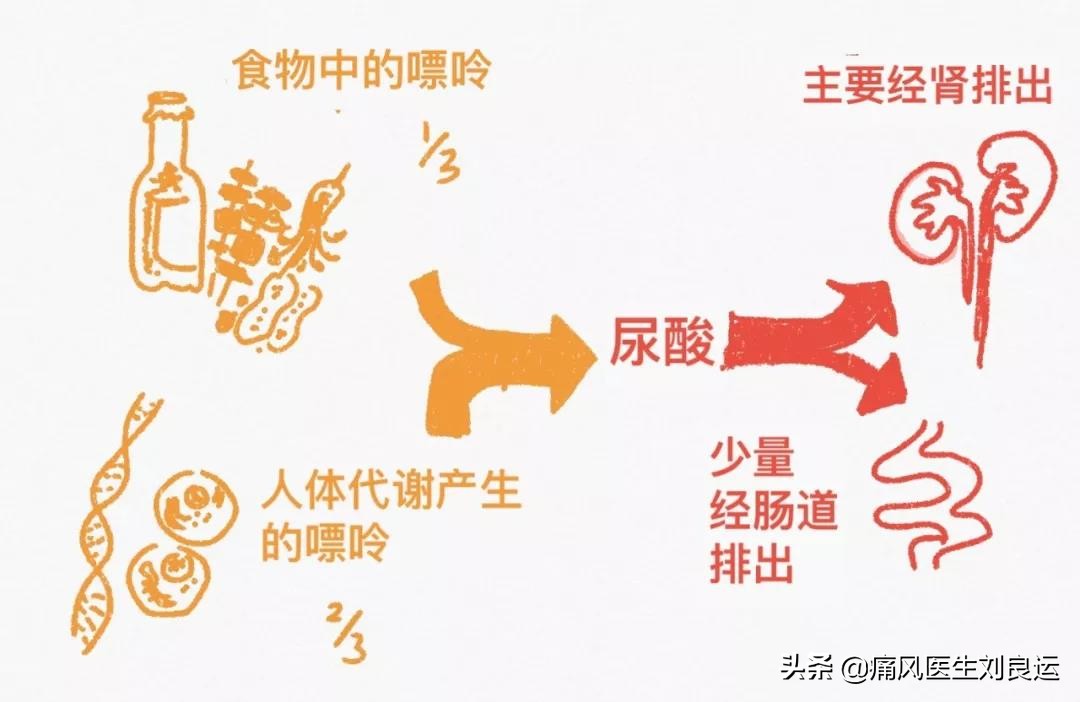 痛风是吃出来的病?尿酸高还是喝出来、累出来、懒出来和胖出来的