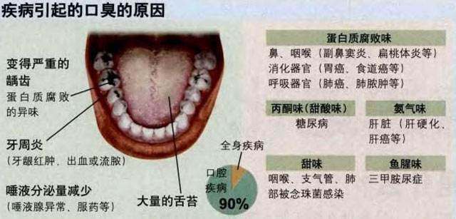 口臭不是病？错！这三种口臭可能是大病信号！