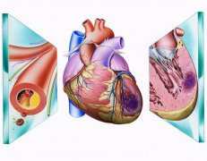 糖尿病合并冠心病，抗心肌缺血首选3类