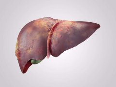 身体有哪些“特征”是肝症“前兆”？