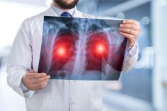 身体出现这4个信号，暗示你的肺或已“