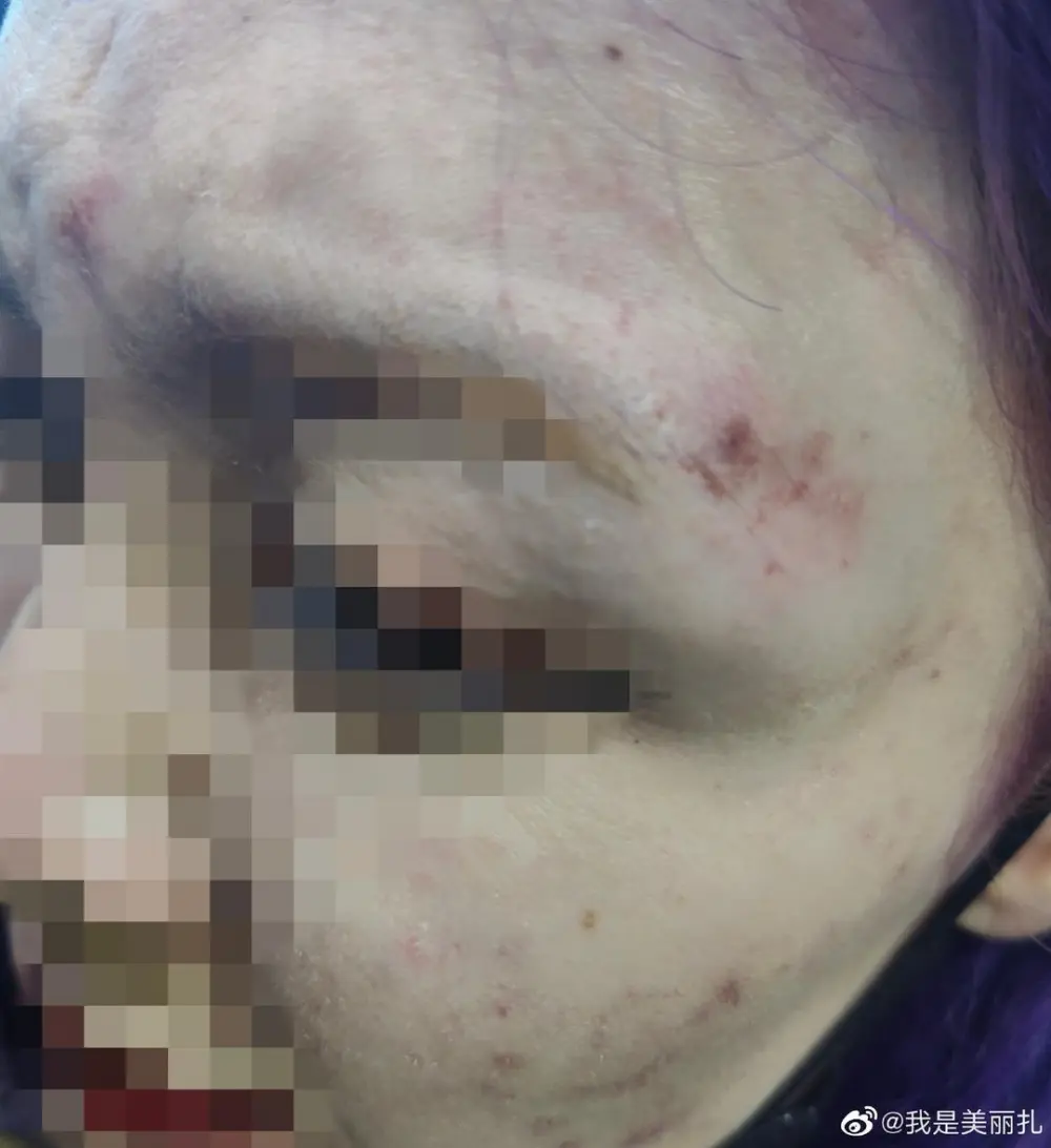 女子称遭山东泰山球员殴打 俱乐部:是否处罚还需根据具体情况